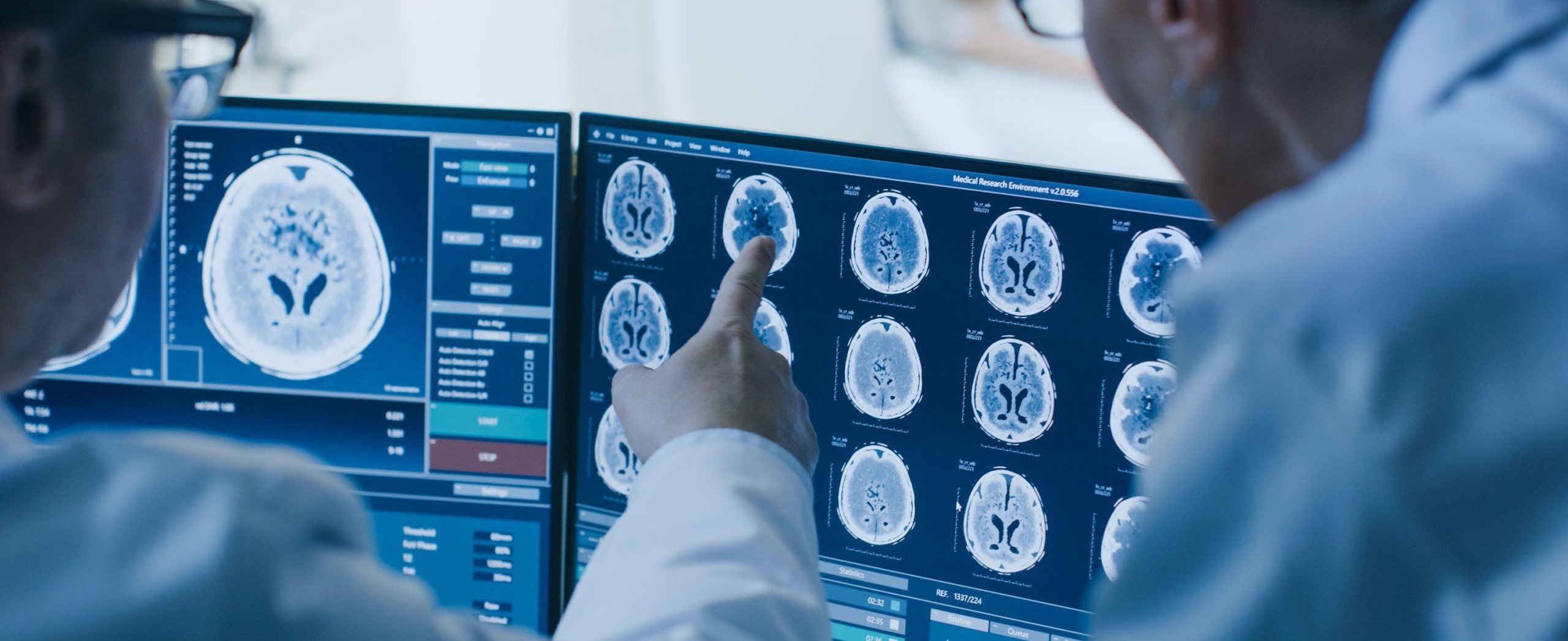 Brainstem Concussion Studies